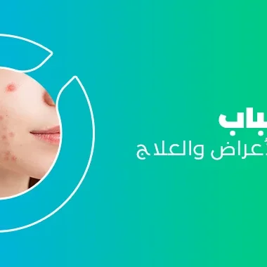 حب الشباب – الأسباب والأعراض والعلاج